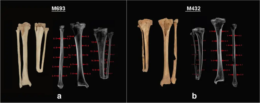 研究対象となった2つの骨格について、切断された下肢骨と無傷の下肢骨のX線画像の比較