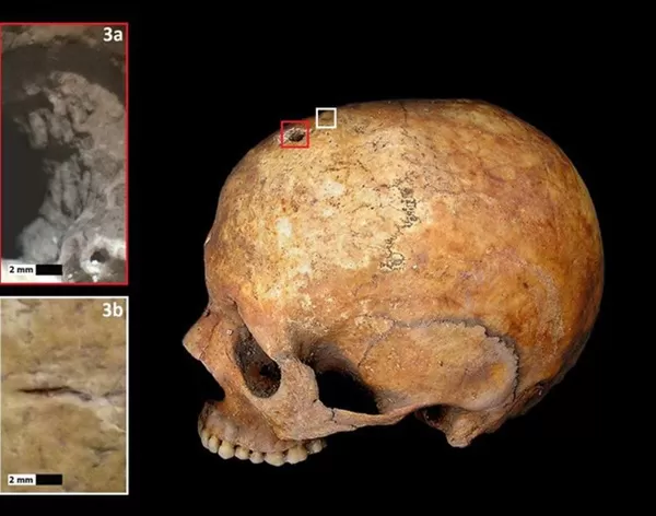 Le mystère du squelette vieux de 1 300 ans qui accouche dans un cercueil et l'explication du phénomène qui fait frémir beaucoup de gens - 3