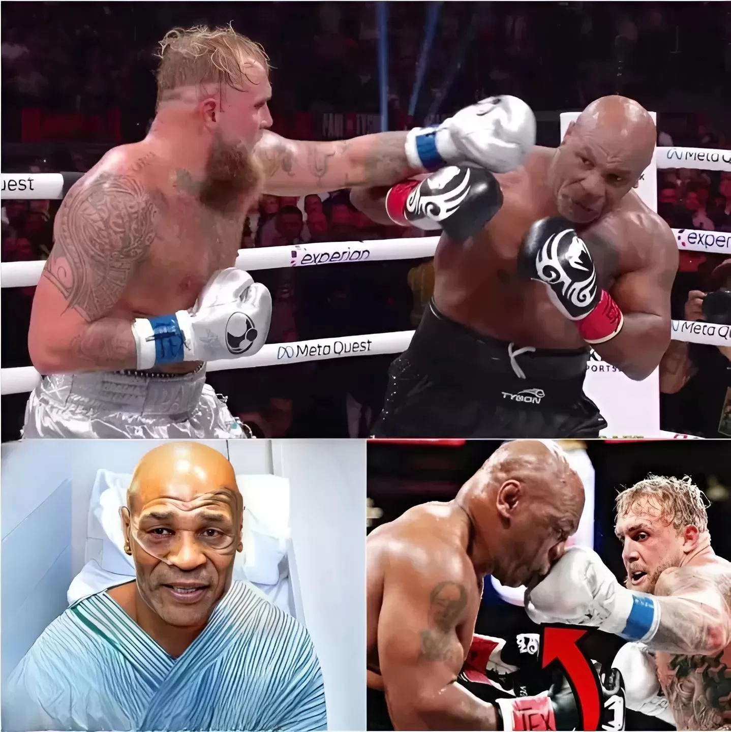 Cover Image for 🛑Mike Tyson PRIMER DÍA Después de Pelea con Jake Paul Lo LLeva al Hosp!tal