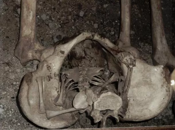 Medieval Woman Gave Birth AFTER Her Death | Ancient Origins