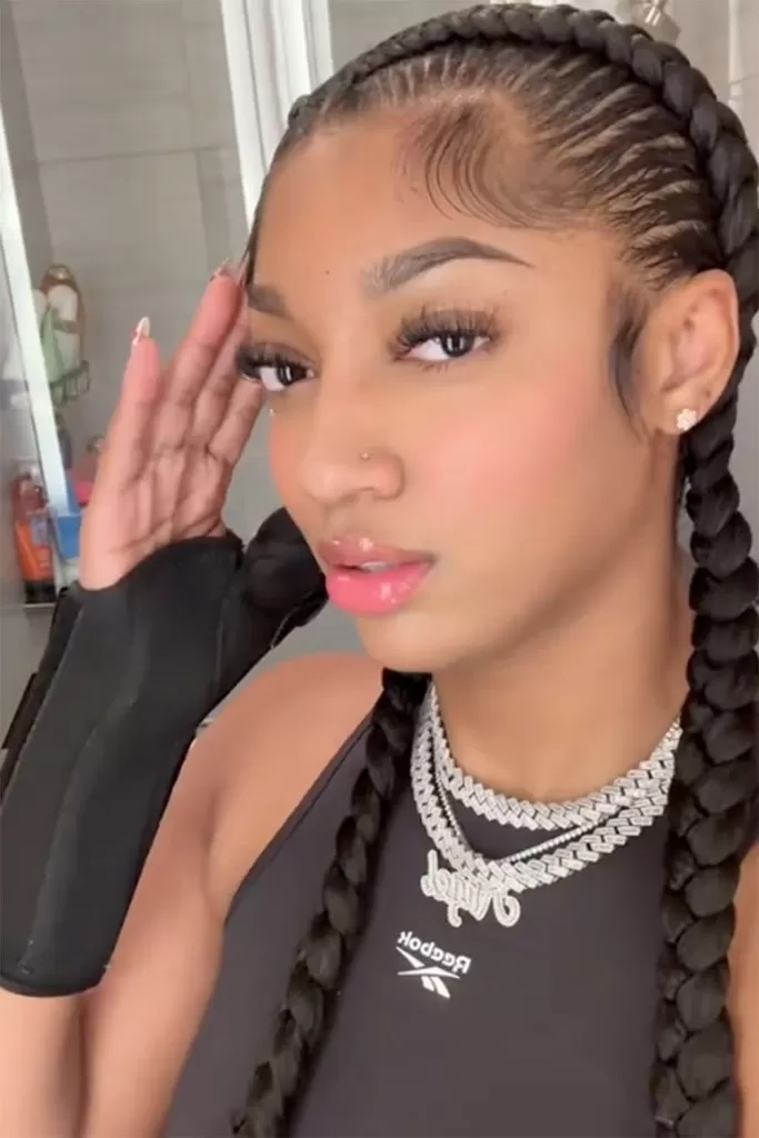 Angel Reese a expliqué sa blessure au poignet mettant fin à sa saison dans une vidéo sur TikTok le 8 septembre 2024.