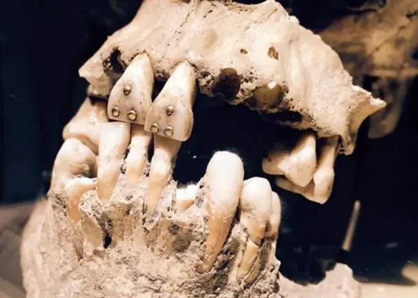 Rare Treasures Discovered in Teeth Unearthed in a Mexican Cemetery