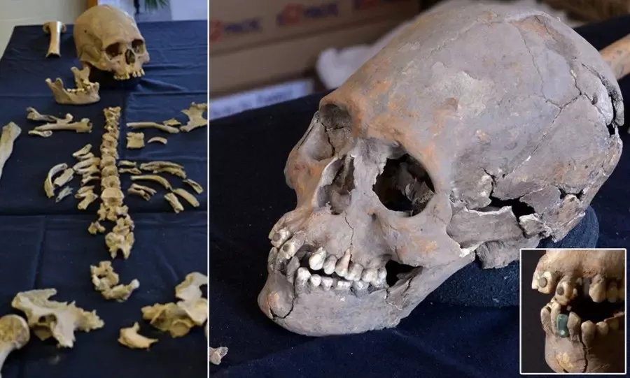 Rare Treasures Discovered in Teeth Unearthed in a Mexican Cemetery