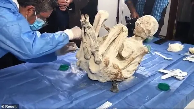 Les momies ont été récemment analysées par le Dr David Ruiz Villa, ancien président de l'Association médicale péruvienne, qui a déterminé qu'elles possédaient des organes semblables à ceux des humains avec des structures cérébrales visibles.